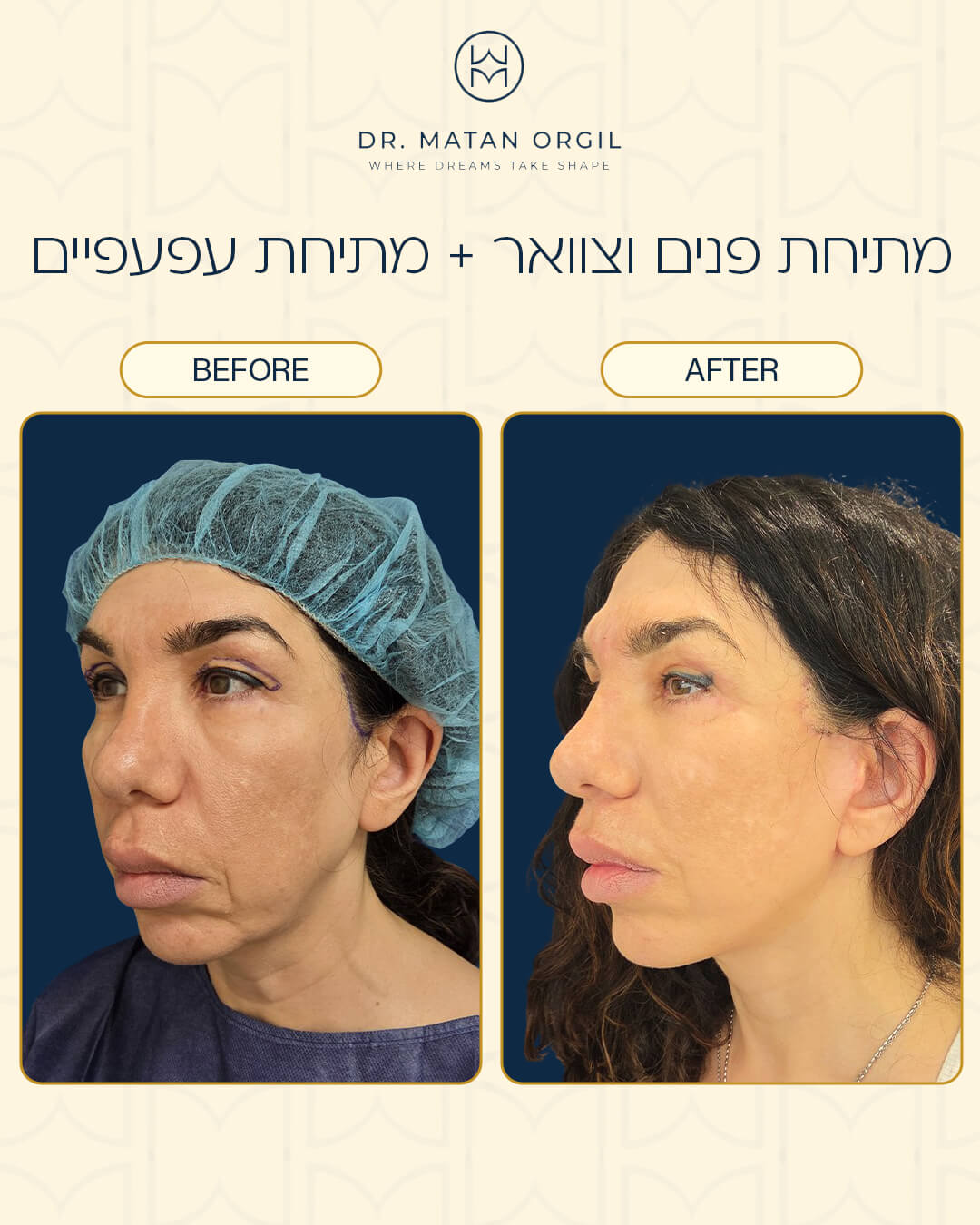 תוצאת טיפול אסתטי 2
